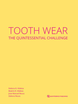 cover image of Tooth Wear